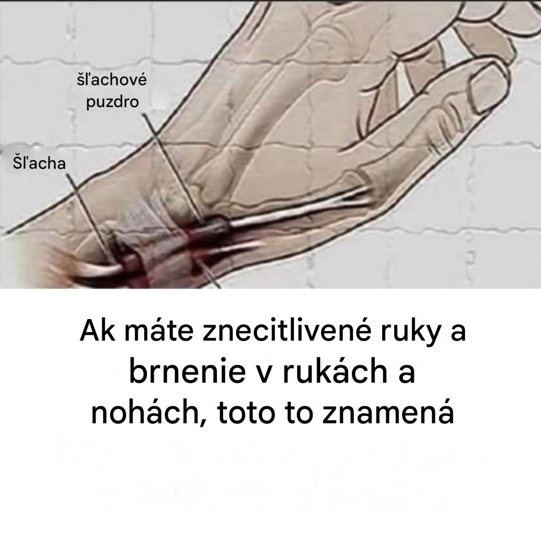 Brnenie a znecitlivenie v rukách: skrytý odkaz, ktorý by sa nemal ignorovať
