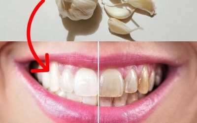 Cesnak: prírodný poklad pre optimálnu ústnu hygienu