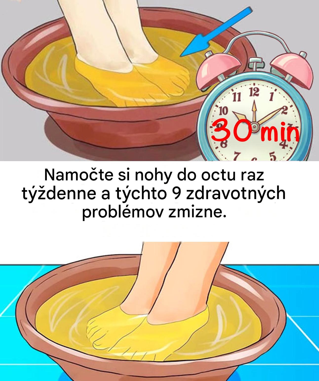 9 neočakávaných výhod jablčného octu: Prírodná starostlivosť o nohy doma