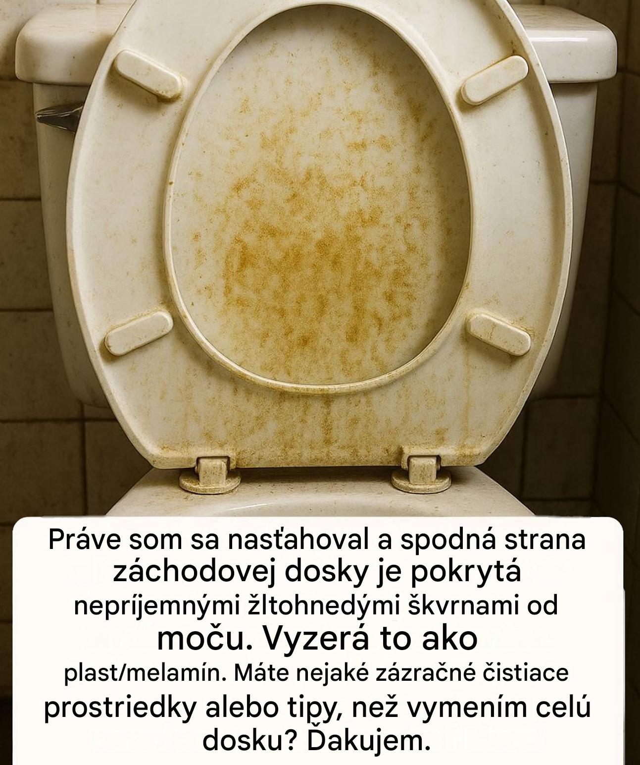 Ako mám vyčistiť sedadlo toalety?