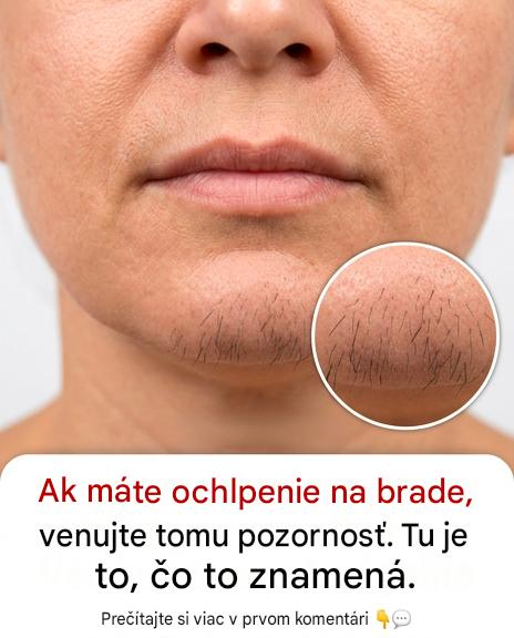 Ak ste žena s ochlpením na brade, toto to skutočne znamená