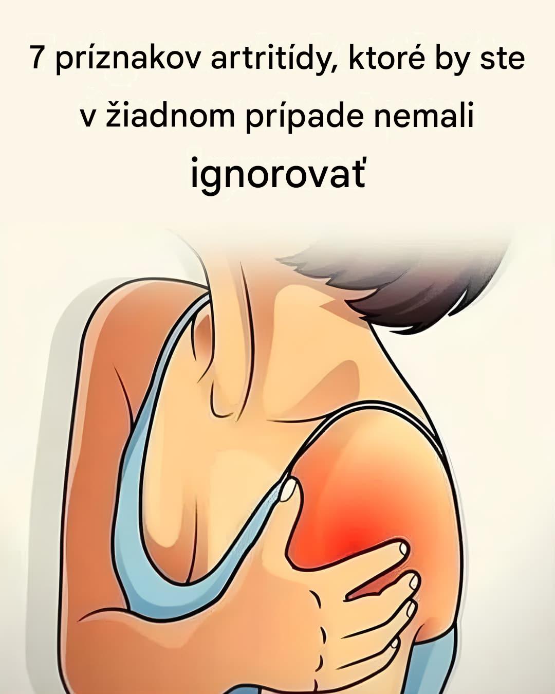 Neznáme príznaky artritídy, ktoré by ste mali brať vážne