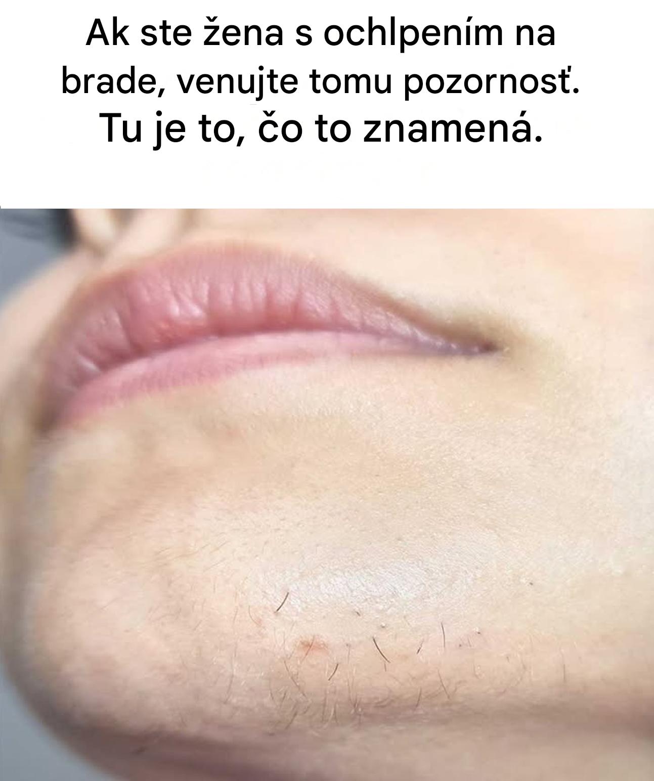 Ženská brada a neočakávaný rast ochlpenia: čo sa vám vaše telo môže snažiť povedať