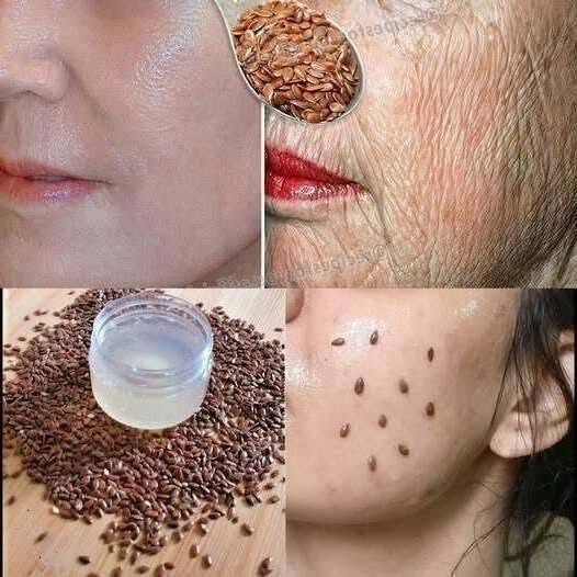 Aj keď máte 70, nanášajte si ho na vrásky – napne vám tvár ako sklo. Lepšie ako Botox!