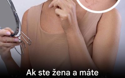 Brada, fúzy alebo broskyňové chlpy: dekódovanie neočakávaného ochlpenia ženského tela