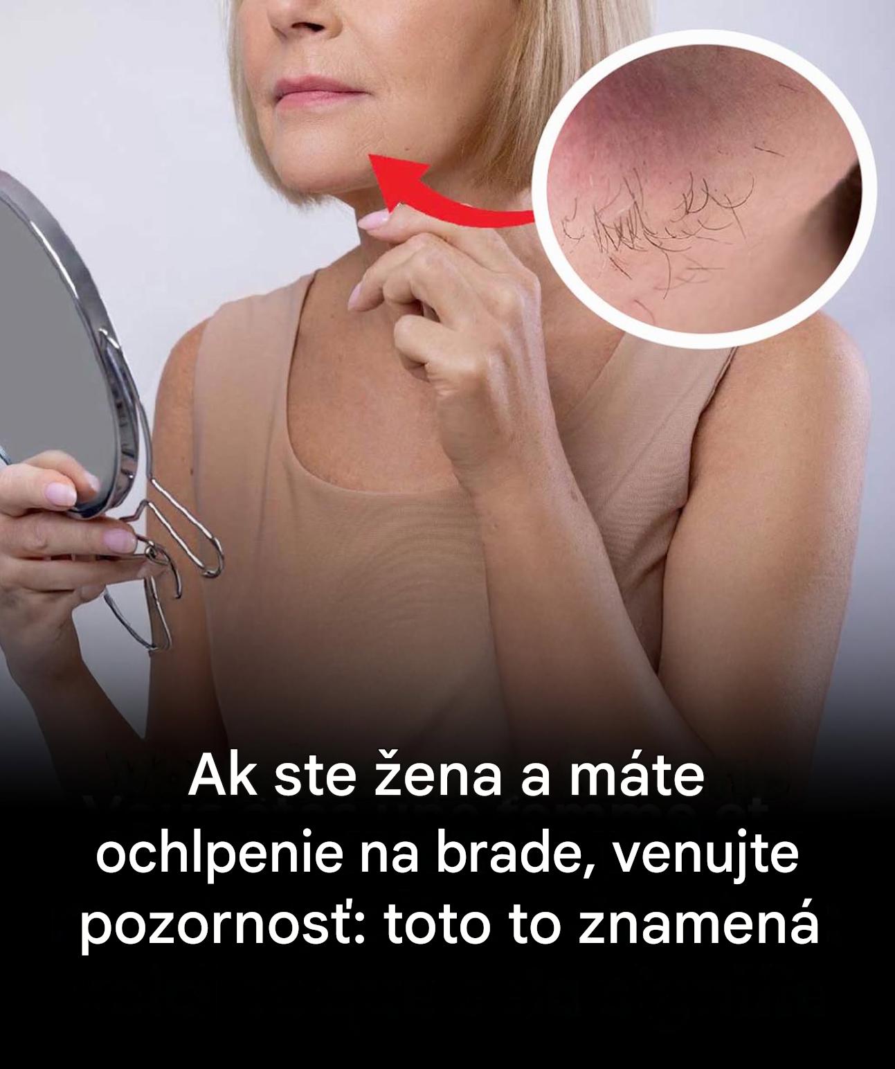 Brada, fúzy alebo broskyňové chlpy: dekódovanie neočakávaného ochlpenia ženského tela