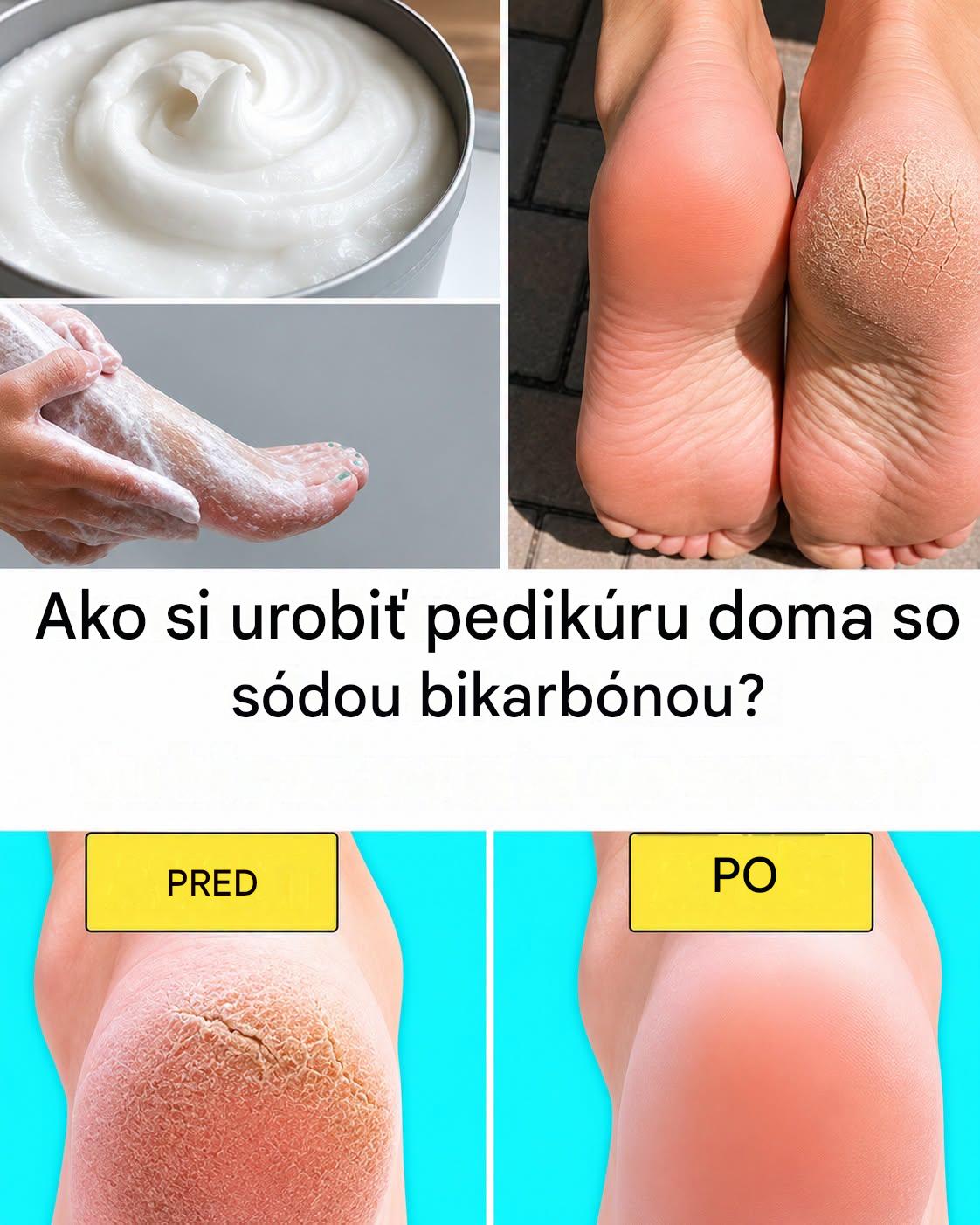 Prírodná starostlivosť: ako úspešne vykonať domácu pedikúru so sódou bikarbónou