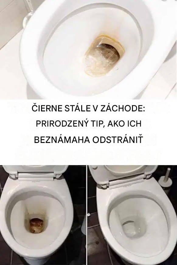 Začiernené toalety: zázračné (a prirodzené) riešenie, ako sa zbaviť odolných škvŕn