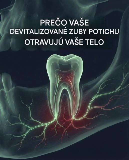 Smrteľné nebezpečenstvo, ktoré pred vami váš zubár skrýva ohľadom ošetrenia koreňových kanálikov zubov