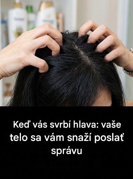Svrbi vás pokožka hlavy? Rozoberieme vám príčiny tohto problému.