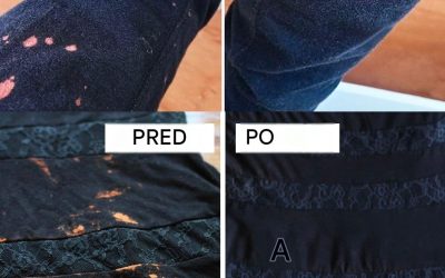 Zachráňte svoje oblečenie poškodené bielidlom pomocou týchto užitočných tipov