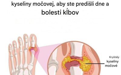 Ako prirodzene zmierniť dnu a bolesti kĺbov