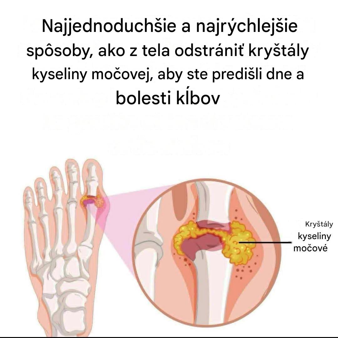 Ako prirodzene zmierniť dnu a bolesti kĺbov
