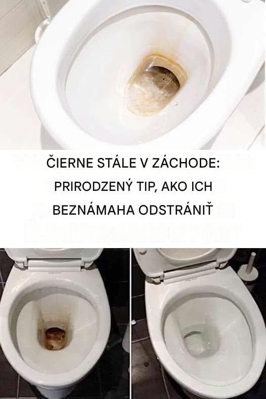 Toalety: Spoľahlivý trik, ako sa rozlúčiť s odolnými čiernymi škvrnami