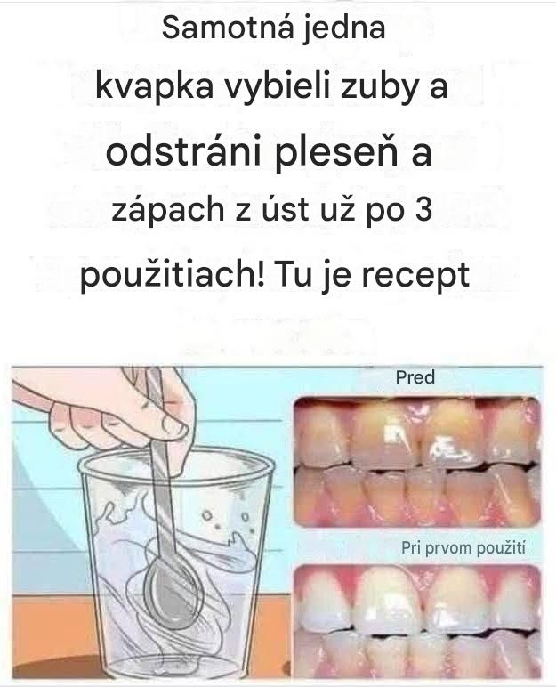 Odstráňte zubný kameň a vybielite si zuby pomocou tohto jednoduchého receptu.