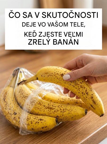 Hnedé škvrny na vašom banáne? Čo prezrádzajú o vašom zdraví (a prečo by ste ich už nemali vyhadzovať)