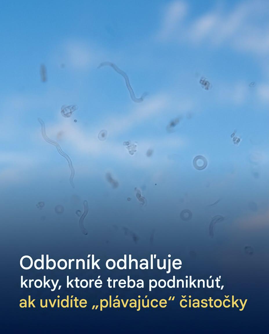 Plaváky v očiach: tie čierne bodky, ktoré sa vám vznášajú pred očami a čo robiť, keď sa objavia