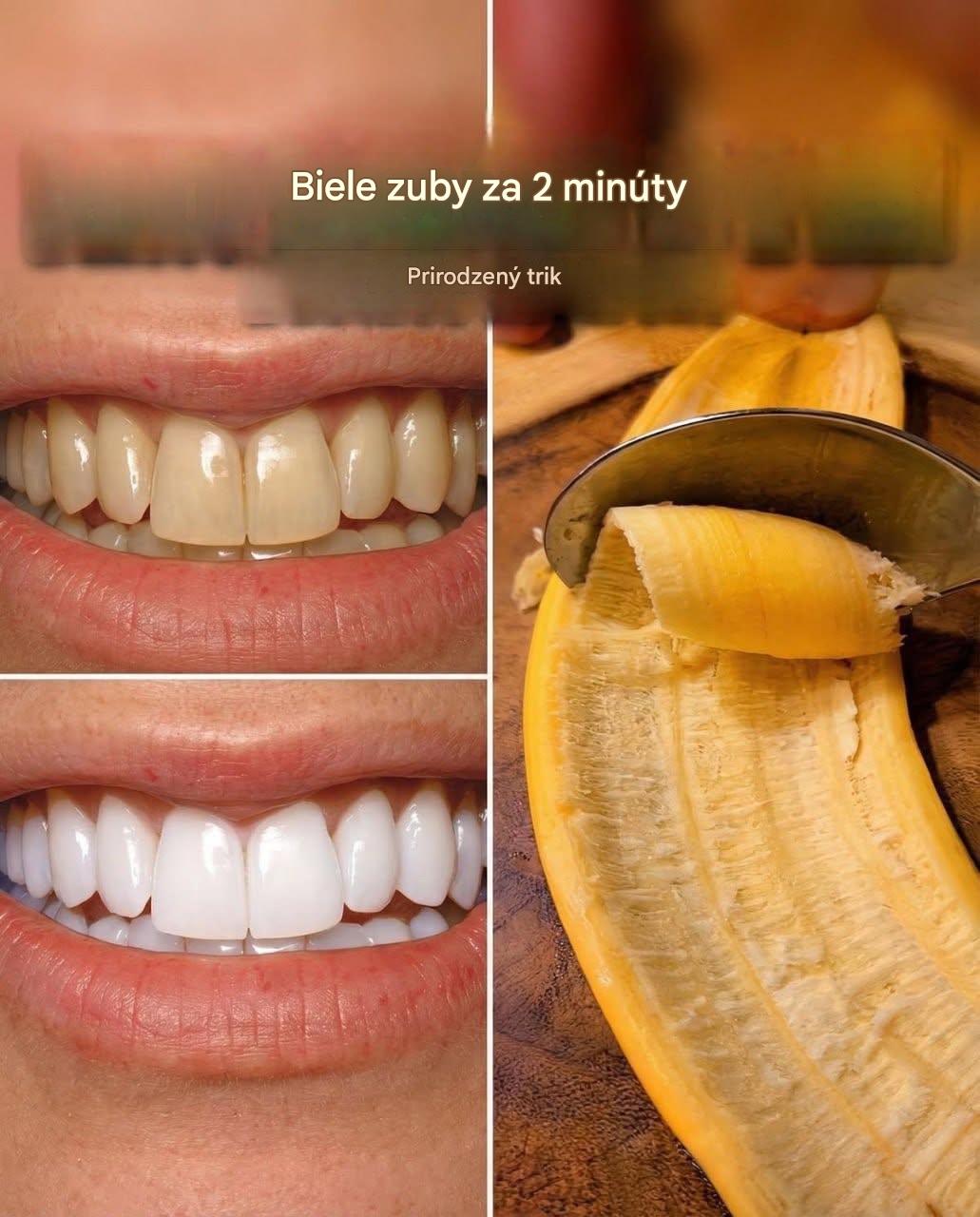 Tajní zubári, s ktorými sa nechcete stretnúť: Odstráni zubný kameň a vybieli zuby iba za 2 minúty