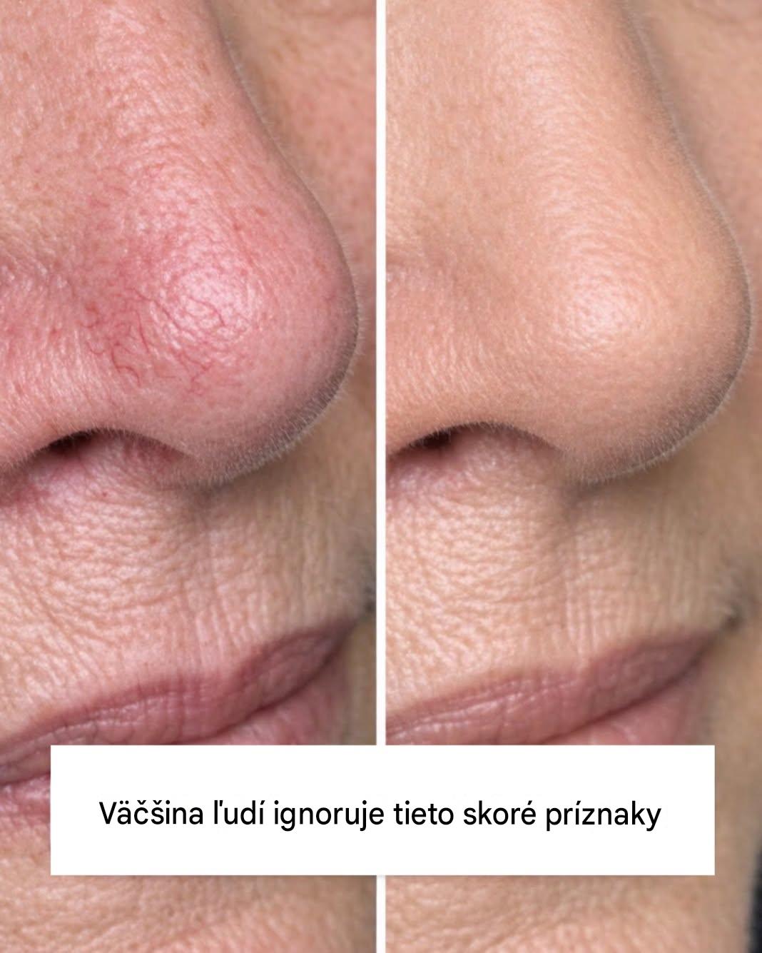 Väčšina ľudí ignoruje tieto skoré príznaky – nebuďte jedným z nich