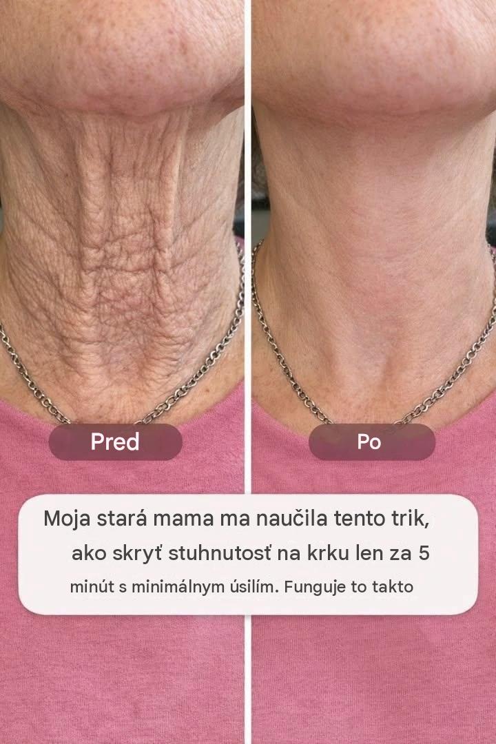 Moja stará mama ma naučila tento trik, ako skryť stuhnutosť na krku za púhych 5 minút bez námahy. Funguje to takto.