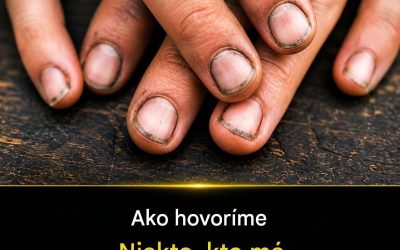 Ako sa hovorí niekomu s takými nechtami? Celý článok v prvom komentári