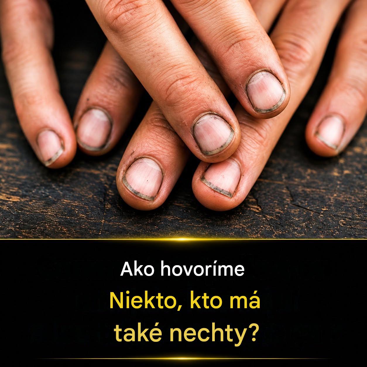 Ako sa hovorí niekomu s takými nechtami? Celý článok v prvom komentári