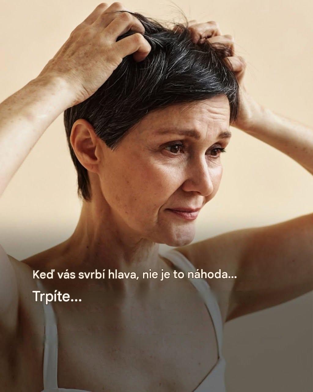 Svrbenie pokožky hlavy: aké sú možné príčiny? Odpovede dermatológa